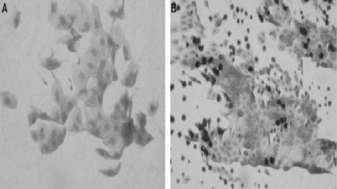 File:Conjunctival Impression Cytology.png