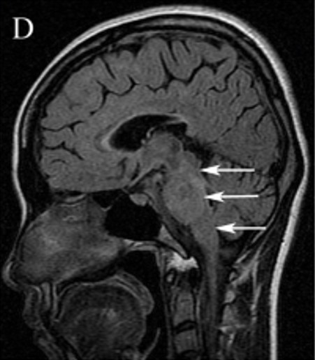 File:ADEM figure 2.jpeg