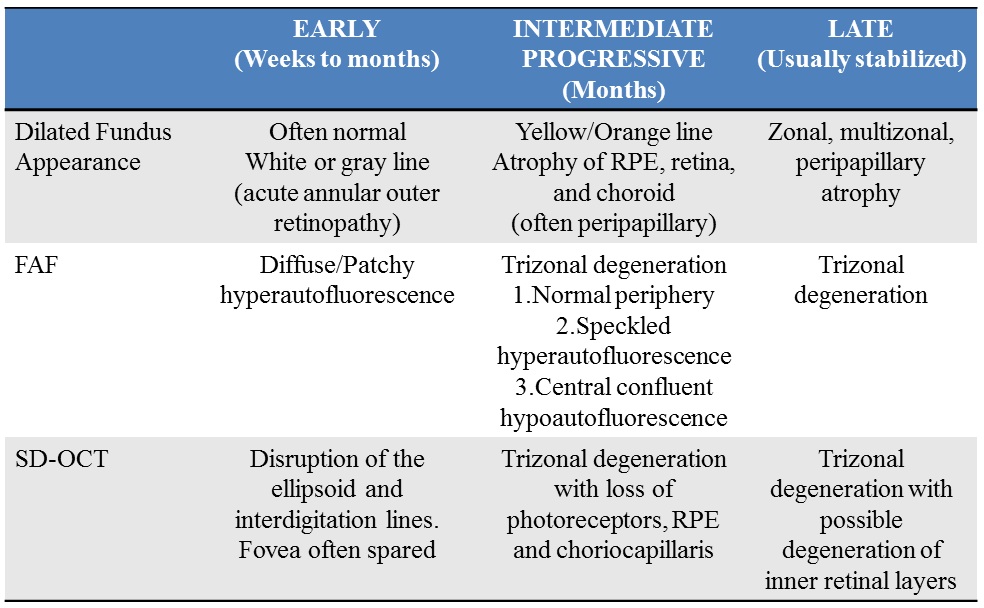 Acute Zonal Occult Outer Retinopathy (AZOOR) - EyeWiki