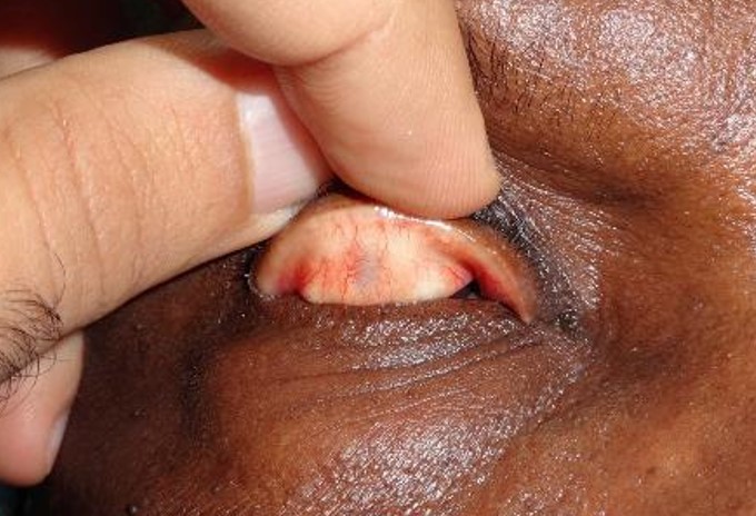 File:Picture2 IKC.jpg