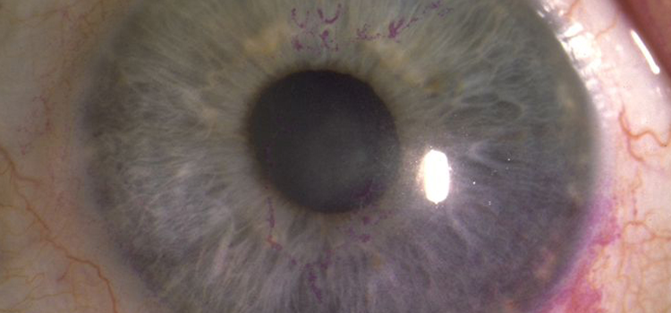 AAO Ophthalmic Education app