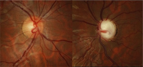 File:CEU fundus.jpg