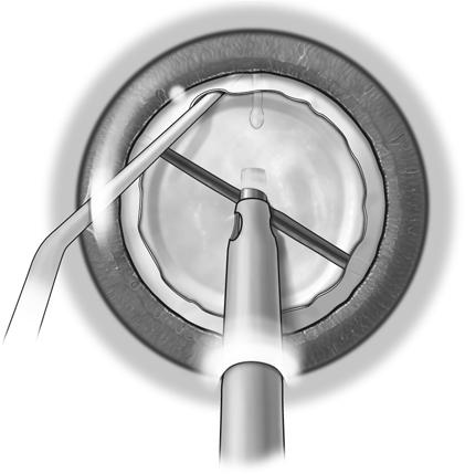 File:AAO - Horizontal Chop.jpg