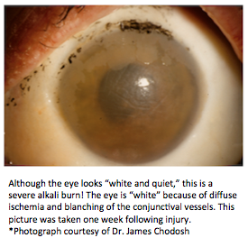 Stage IV chemical burn with text.png