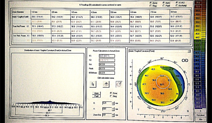 File:Figure 1 Tomography.png