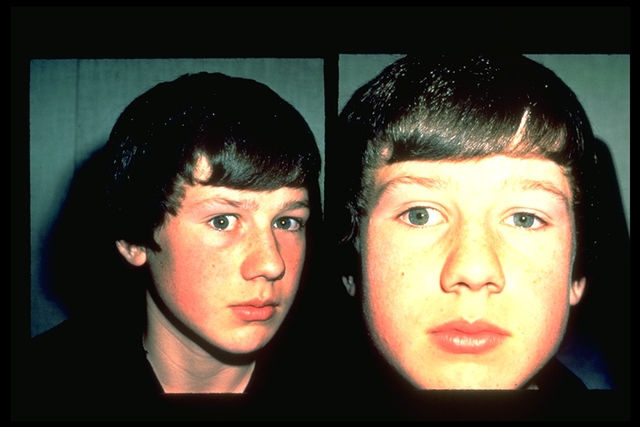 File:Strabismus detection.jpg