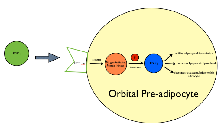 Fig 7: Schematic representing mechanism of adipose changes in PAP. Prostaglandin molecules, specifically PGF2 and its analogues bind the Prostaglandin F receptor (FP) on orbital preadipocytes and activate Mitogen Activated Protein Kinase. This results in the phosphorylation and thus inactivation of Peroxisome Proliferator Activated Receptor Gamma (PPAR-gamma) and results in an overall inhibition of adipocyte differentiation, a decrease in levels of lipoprotein lipase, and a subsequent decrease of fat accumulation within the adipocyte.