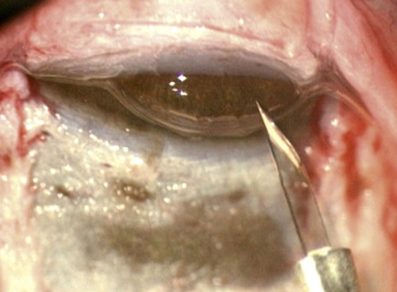 File:Rupture of TDM window.png