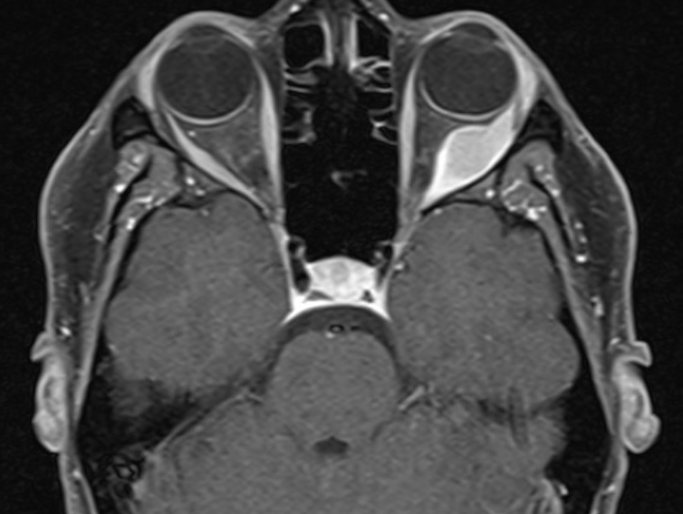 File:GCT MRI Axial.png