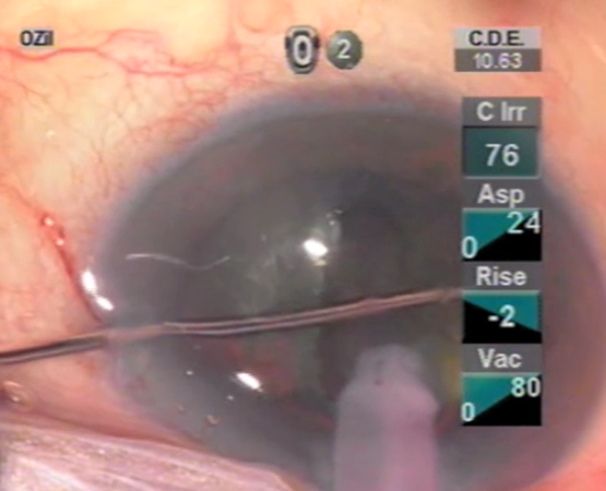 File:ZMS - Picture2.png