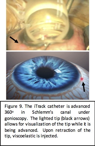 File:Itrack fig 9 .jpg