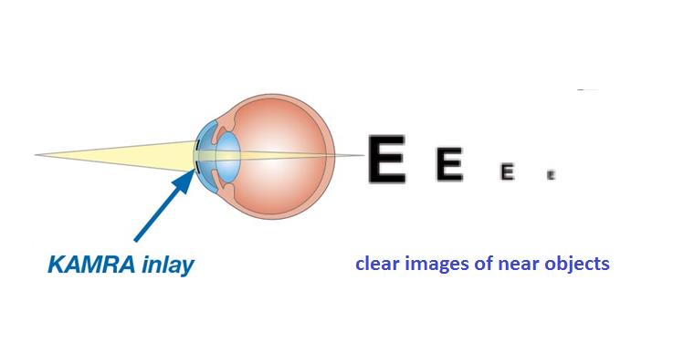 File:Kamra after.jpg