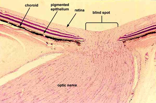 File:Optic nerve SIU.jpg