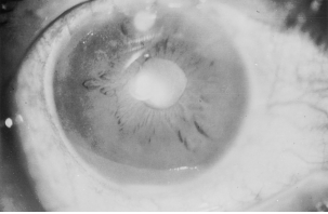 File:Screen Shot 2017-05-28 at 10.34.17 AM.png