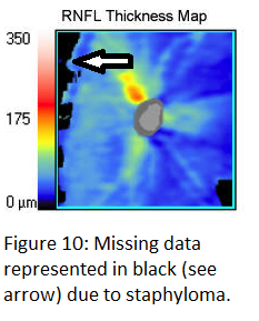 File:Figure 10 SD-OCT.png