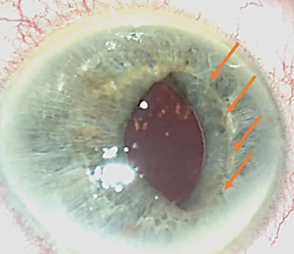 File:Iris capture.jpg