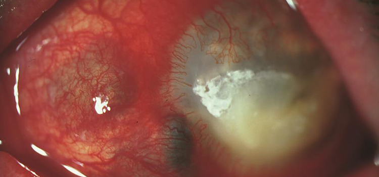 International Contest – Deadline 11:59 PM PST, May 31, 2026