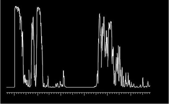 File:Fig. 3A - iris mm us 2.jpg