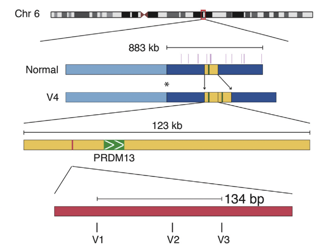 File:MCDR1 locus NCMD.png