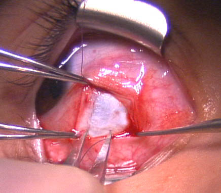 File:Recession 6 copy.jpg