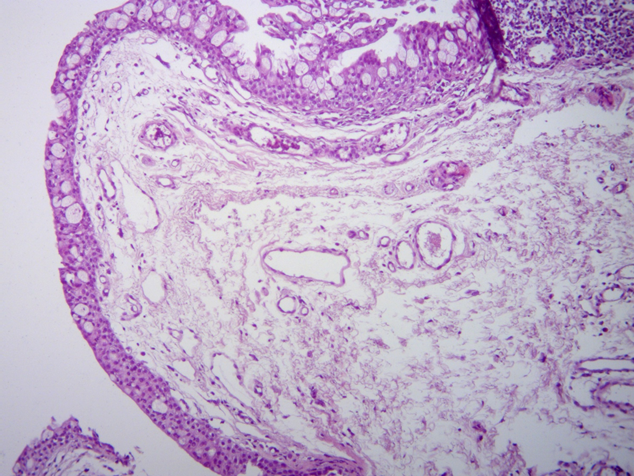 File:CYST 100X.png