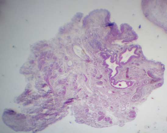 File:PANORAMIC PHOTO CYST.jpg