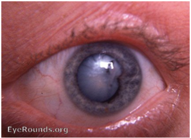 File:Image intumescent2.png