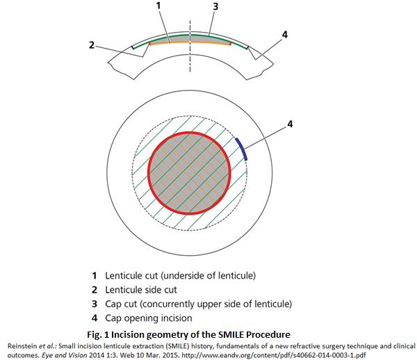 File:Smilef1.jpg