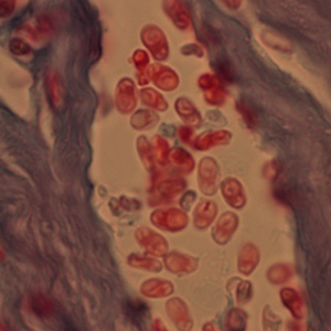 File:Trichrome.jpg