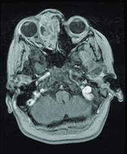 File:Figure 2b-1.jpg