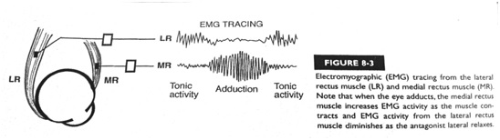EMG tracing demonstrating the neurogenic theory