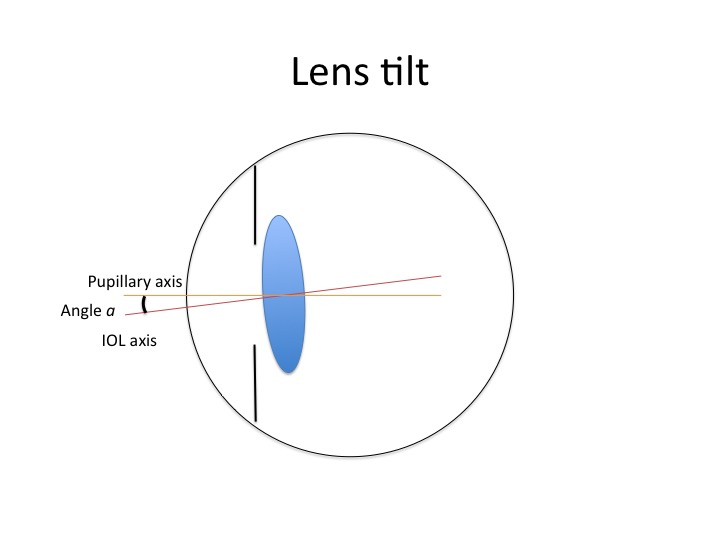File:Lens tilt.jpg
