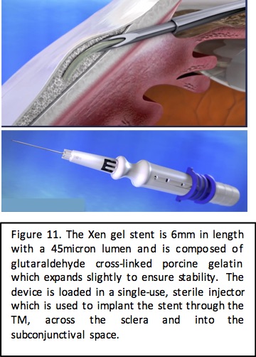 File:Xen fig 11.jpg