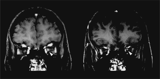 File:ADEM Figure 3.png