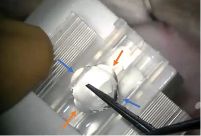 File:Cartirdge injection.jpg