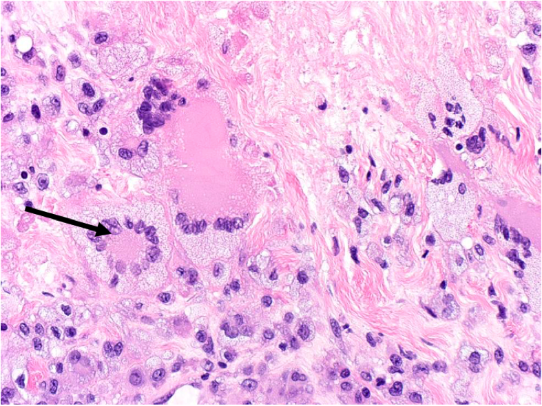 File:NXG Figure 1B.png