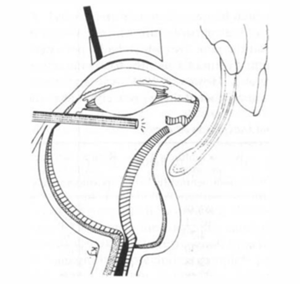 File:Indentation.png