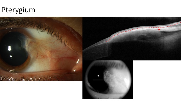 File:Slide7.jpg