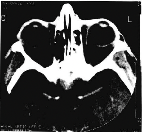 File:Plenum CT.png