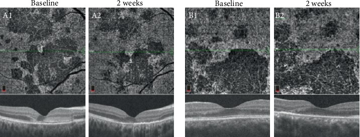 File:APMPPE OCTA.jpg