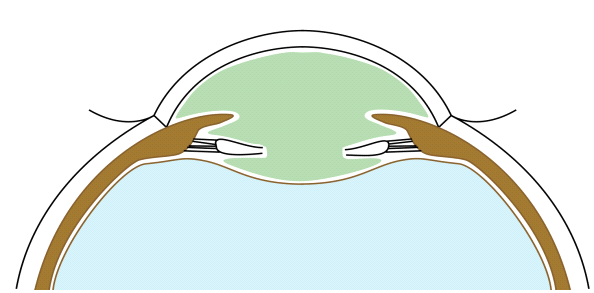 File:Both capsules are joined.png