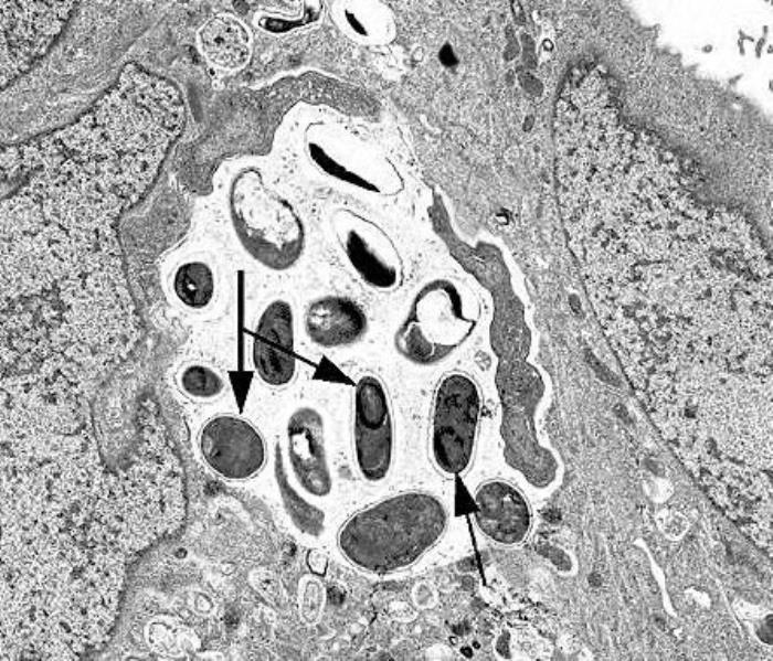 File:TEM.jpg
