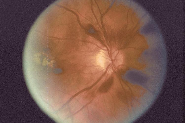 File:AA0 54317-2.jpg