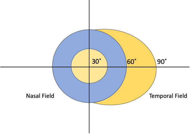 File:Temporal Crescent Syndrome Figure 1.png