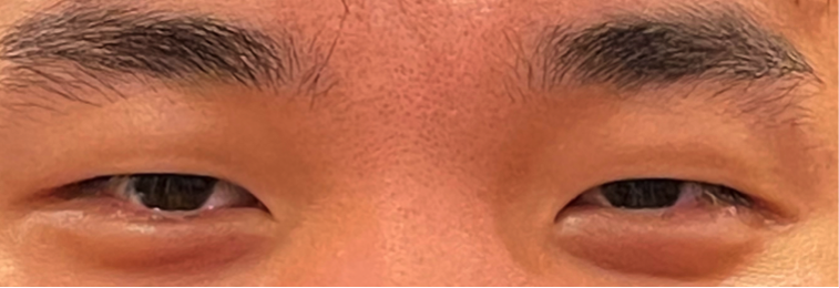 File:Image 1 nocrease.png
