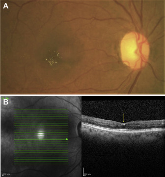 File:West african.jpg