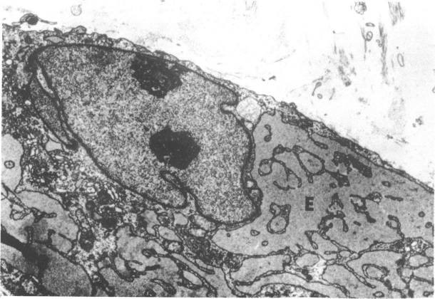 File:Activated fibroblast.jpg