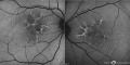 Thumbnail for version as of 09:49, November 22, 2015