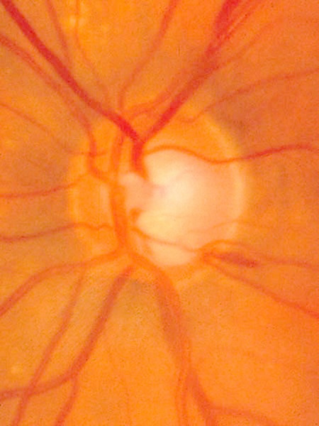 File:Disc heme.jpg