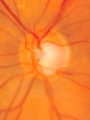 Thumbnail for version as of 14:31, July 7, 2010